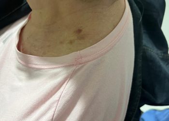 Idosa vítima de roubo, em Tijucas